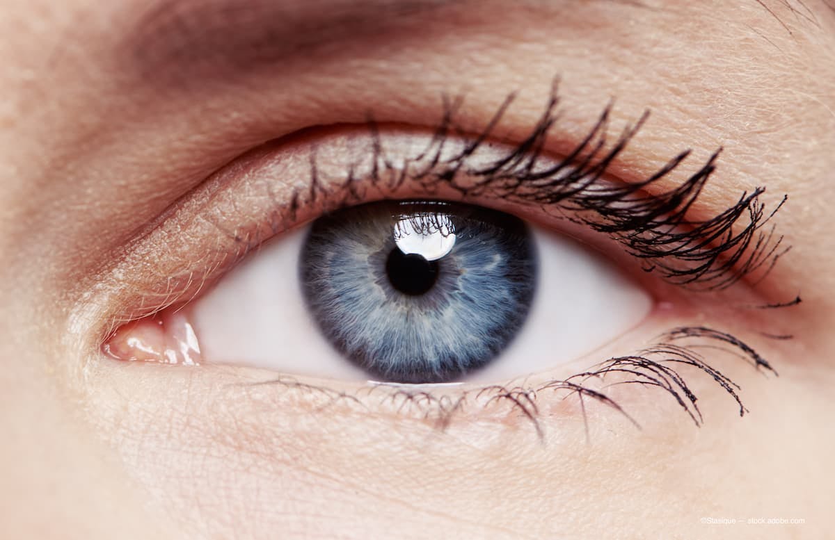 Closeup of young woman's healthy eye. (Image Credit: AdobeStock/Stasique)