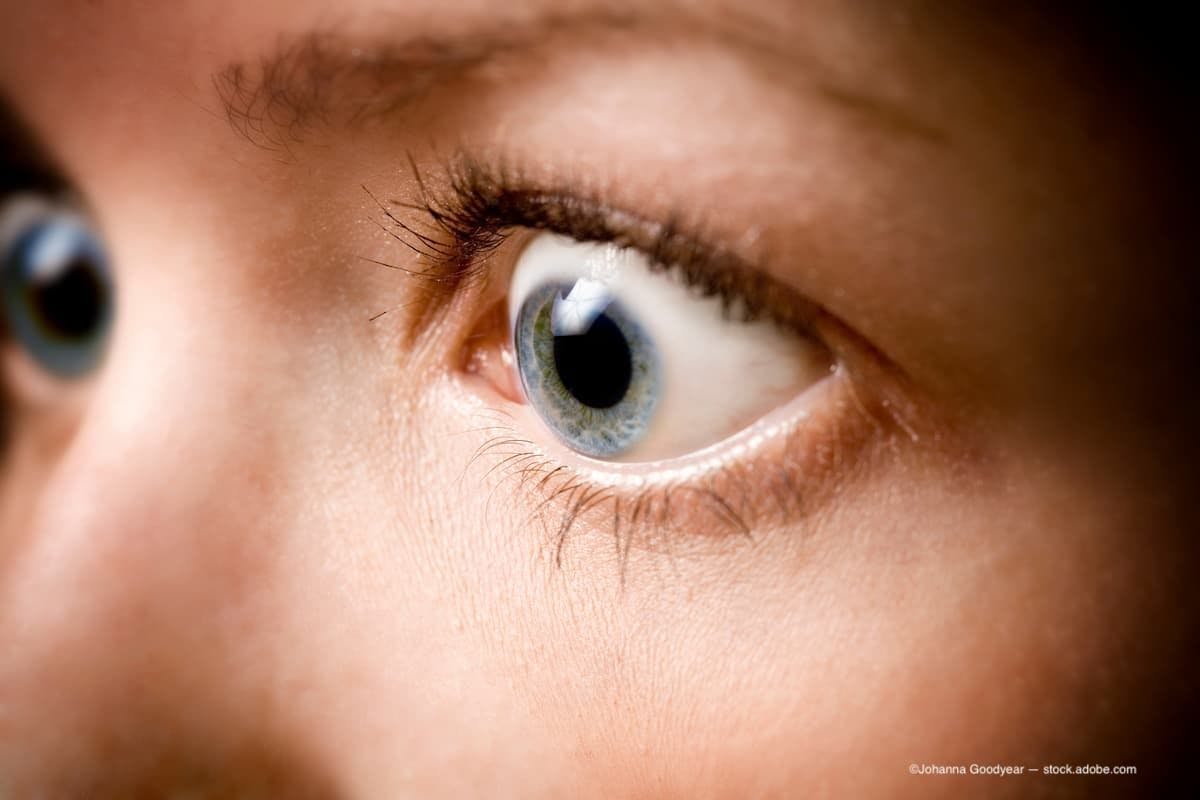 An image of bulging eyes. (Image Credit: AdobeStock/Johanna Goodyear)