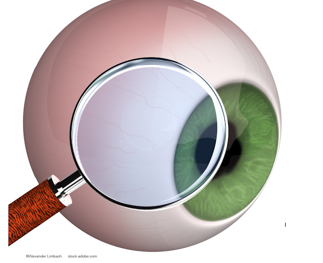 Survey: Awareness of biosimilars for retinal diseases in the US and Europe