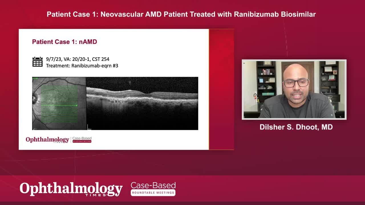 Patient case 1: Neovascular AMD Patient Treated with Ranibizumab Biosimilar 