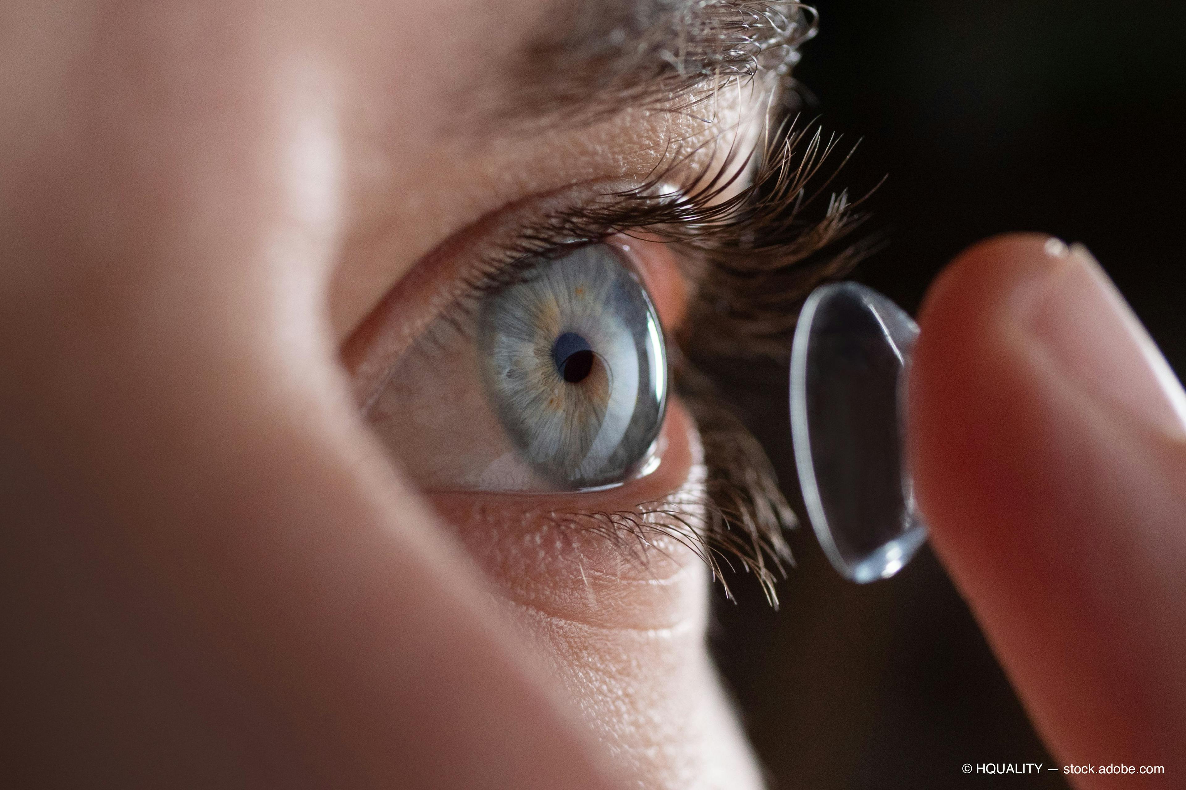 Artificial tears offers a path to contact lens comfort