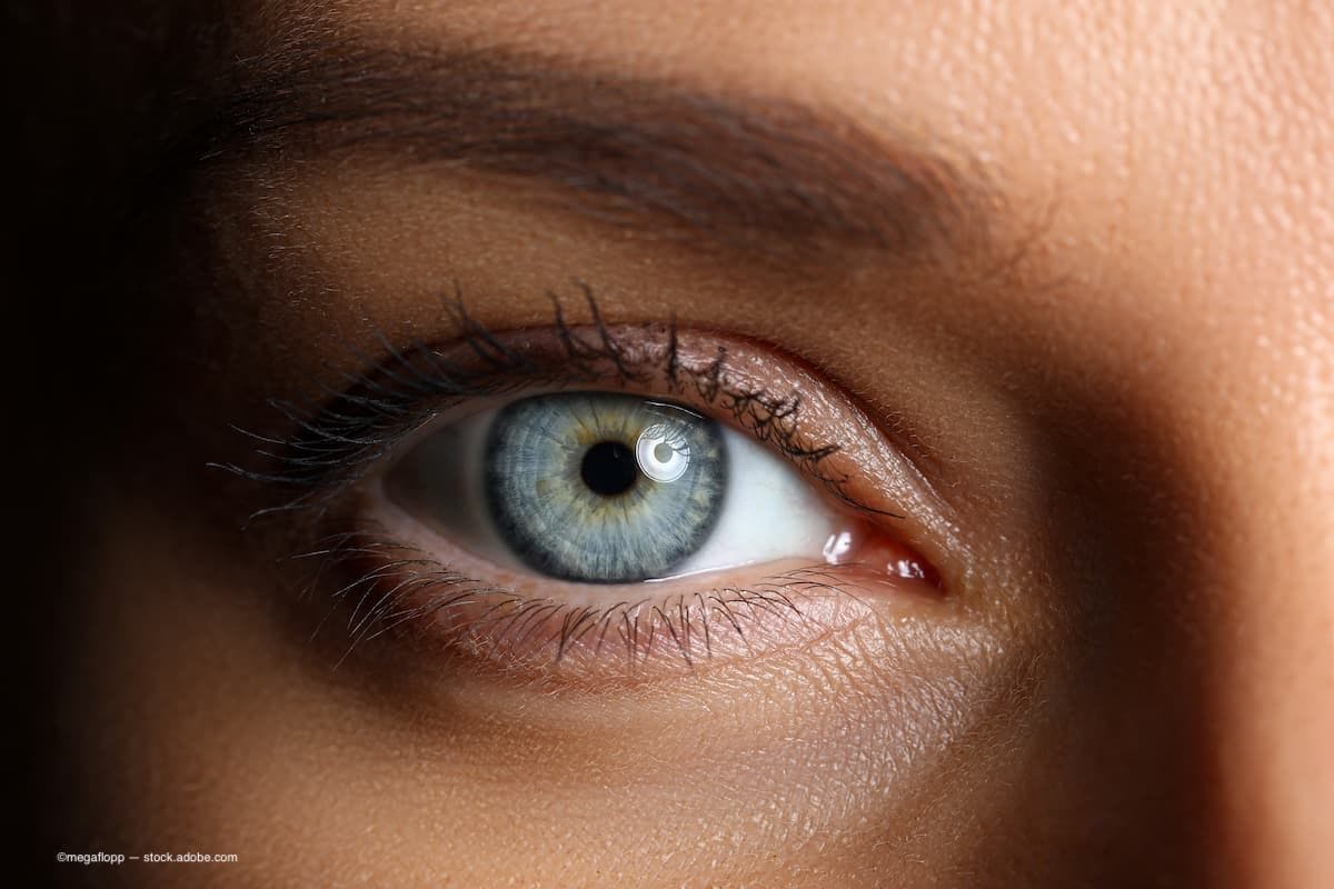 Study examines method to detect, localize retinal detachments in eyes filled with silicone oil