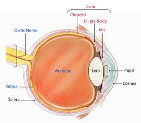 Clinically, uveitis can affect the anterior chamber, the vitreous, and the choroid and/or retina. Image courtesy of the National Eye Institute