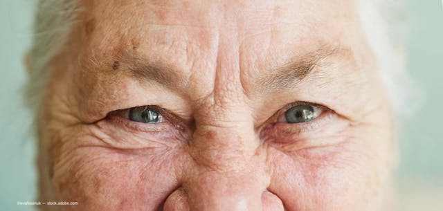 Alzheimer’s disease changes may be reflected in the eyes first