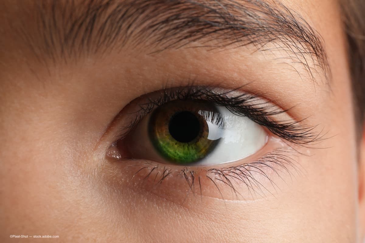 COVID-19 treatment changes infant’s eye color