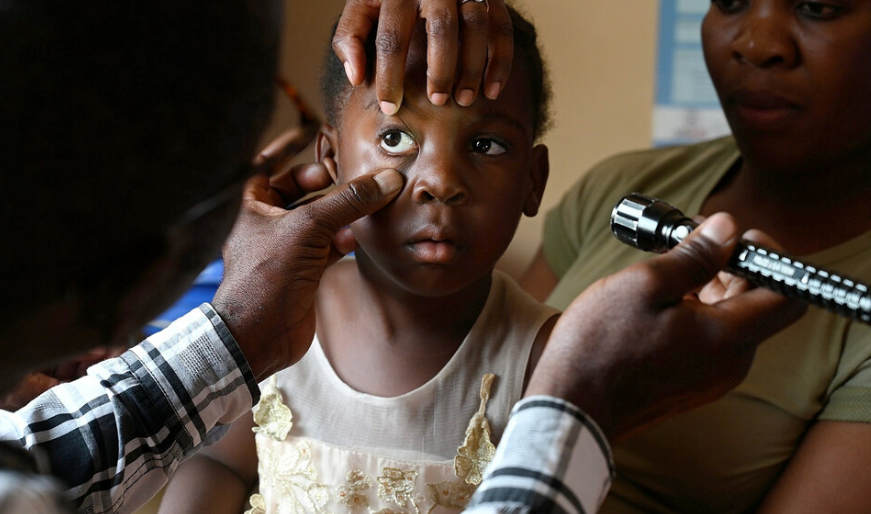 Four-year-old Kapiya has an eye exam by an Orbis-trained community health worker in Mufulira, Zambia. (Image courtesy of Orbis International)