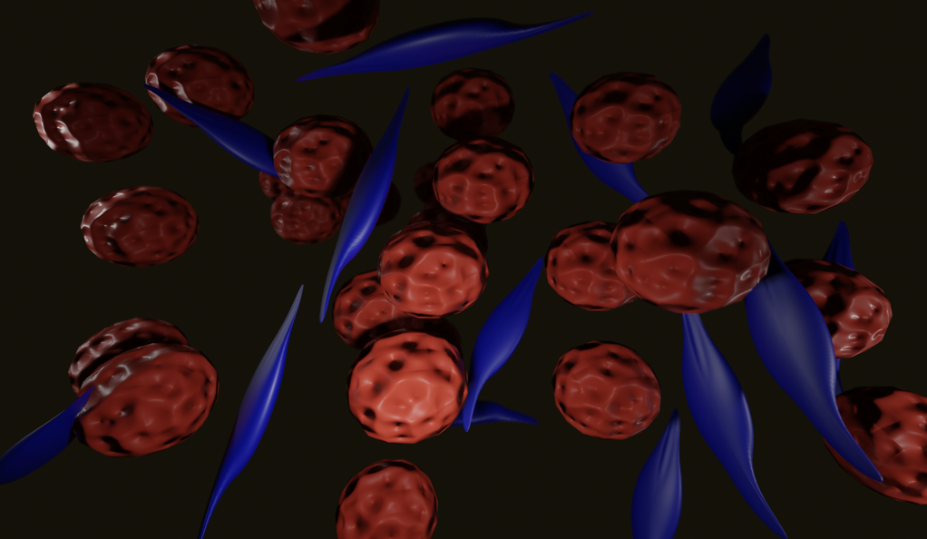 An illustration showing two different cell subtypes within individual tumors; an indolent subclone with spindle morphology (blue) and an aggressive one with round ‘epithelioid’ morphology (red).