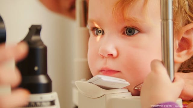 Keratoconus in a pediatric population has higher prevalence than expected