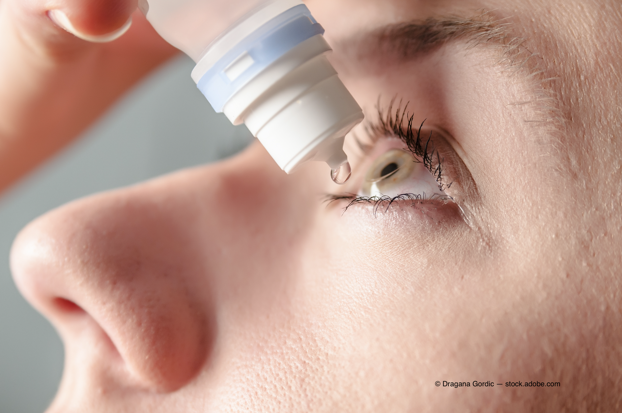 How novel autoantibodies may improve screening dry eye patients for Sjogren's syndrome