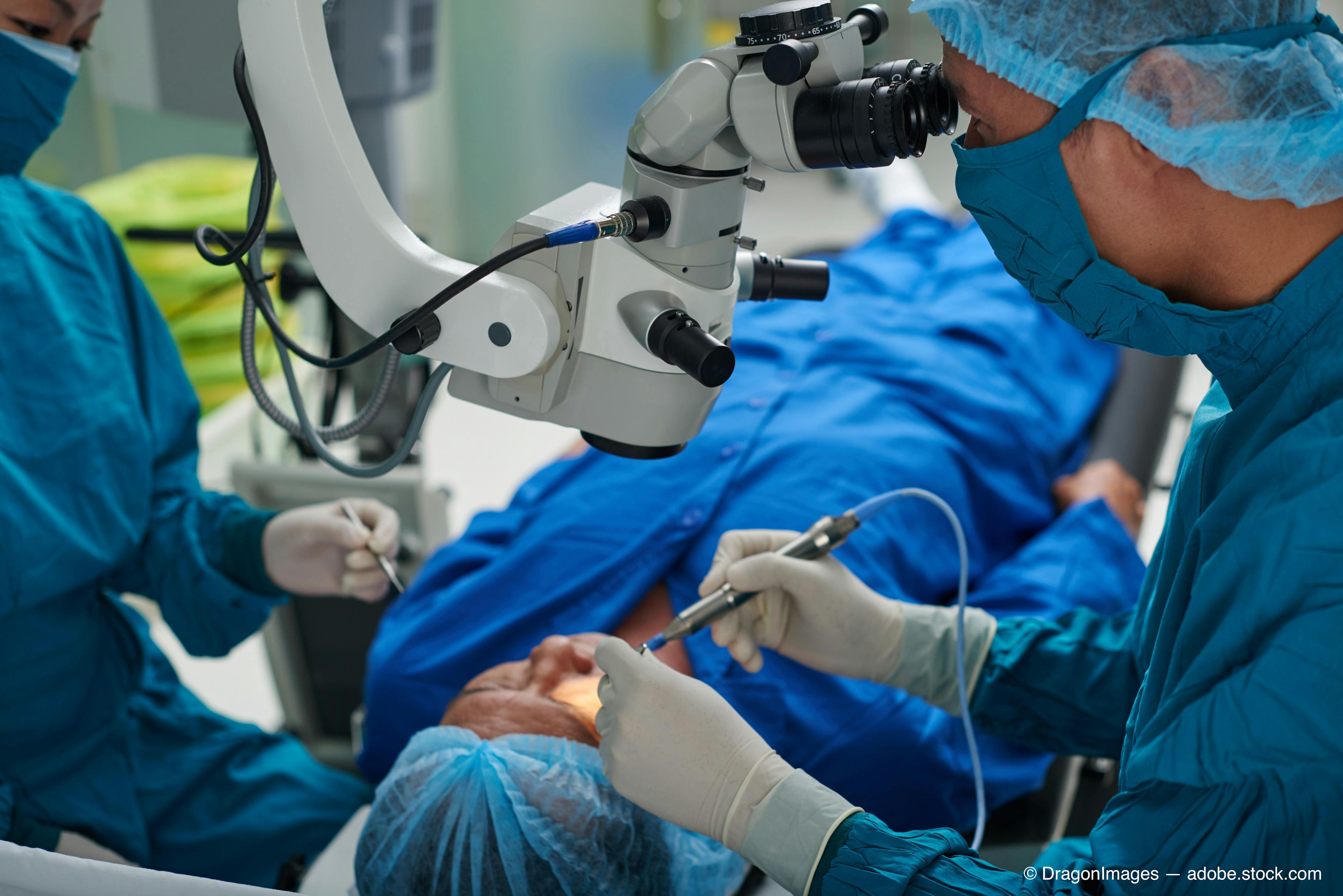 Study examines dropless cataract surgery