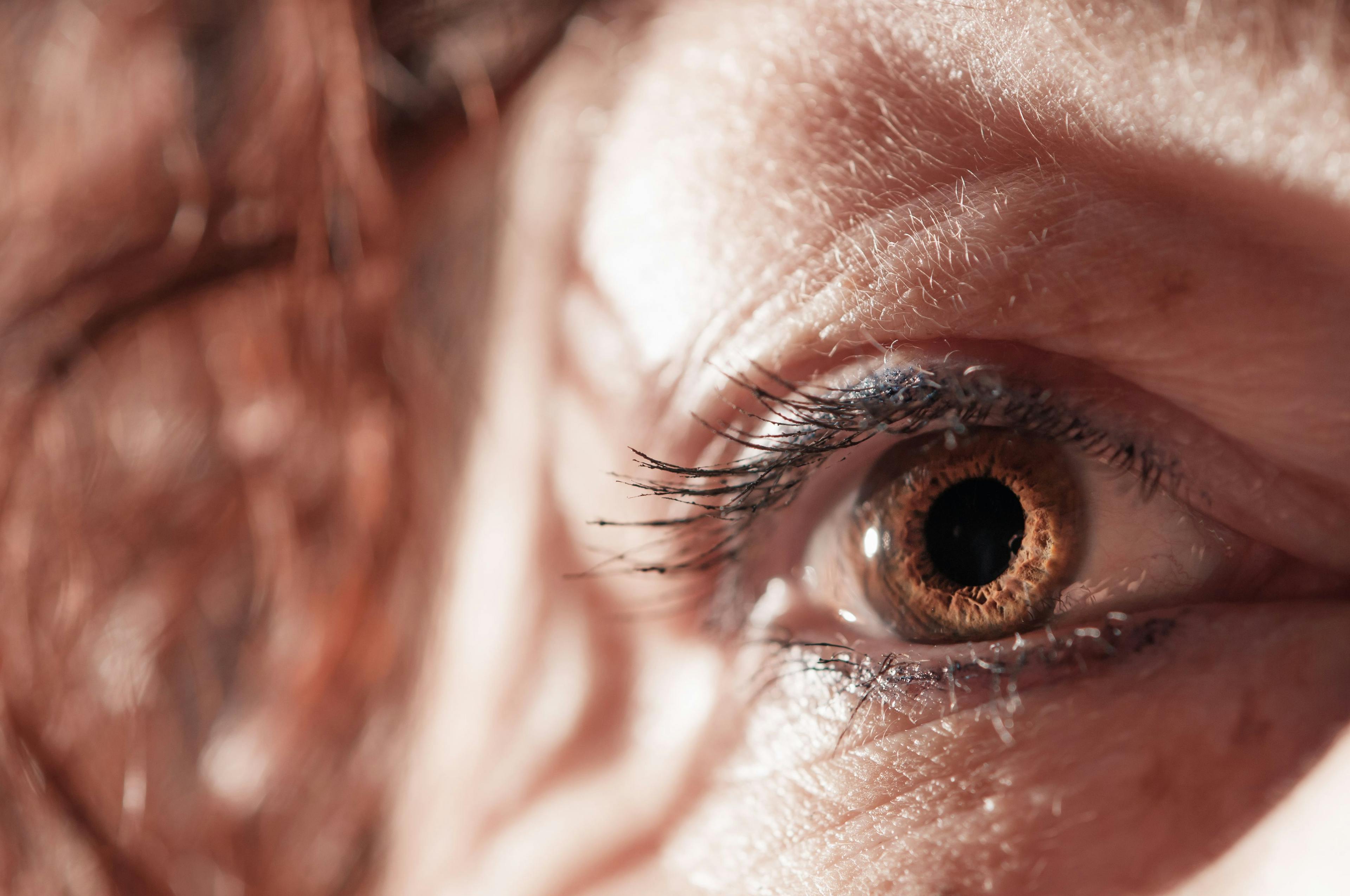 Exploratory data analysis from the trial of lampalizumab (Genentech/Roche) has shed new light on the behavior of geographic atrophy (GA), the advanced form of age-related macular degeneration (AMD) (Adobe Stock Image)