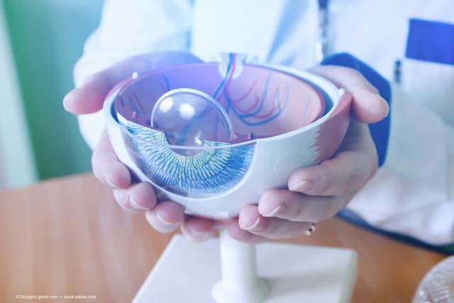 There’s more to cataract surgery than meets the eye