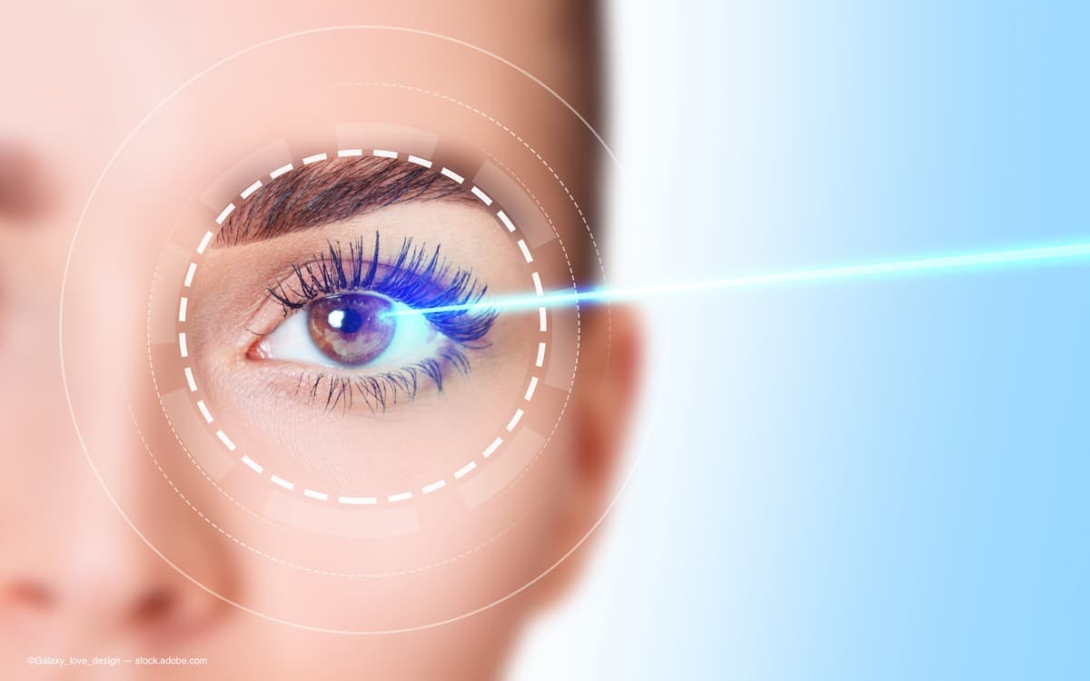 a female eye with a laser going into it to correct vision. (Image Credit: AdobeStock/Galaxy_love_design)