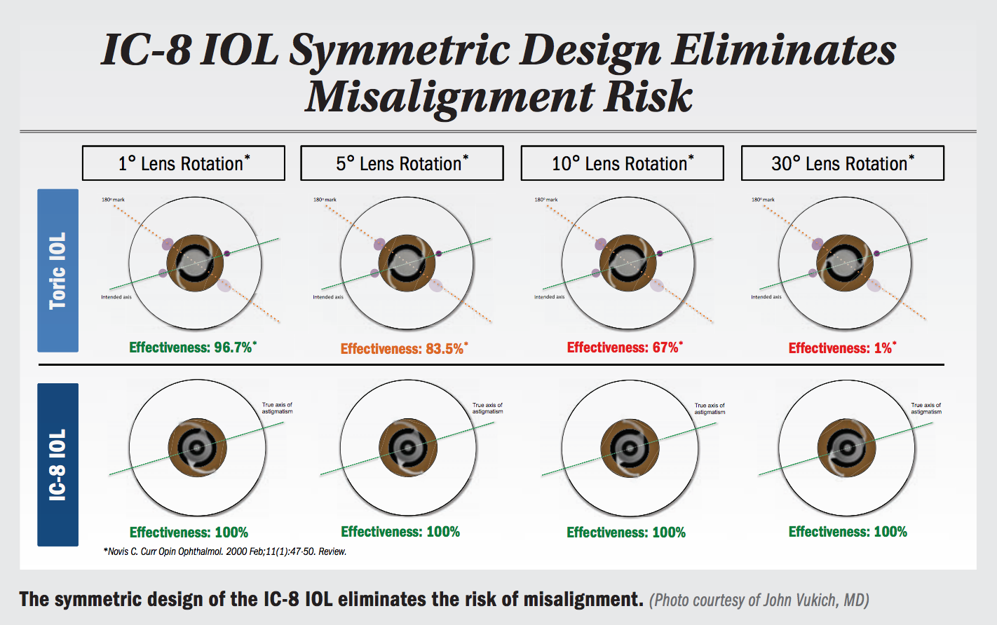 IC-8 IOL symmetric design eliminates misalignment risk
