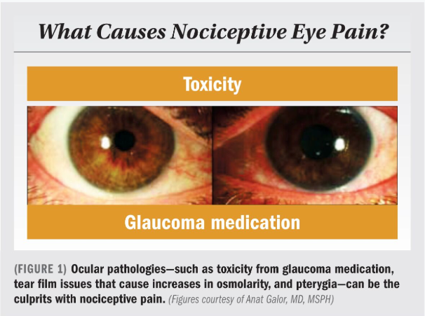 Ocular pathologies