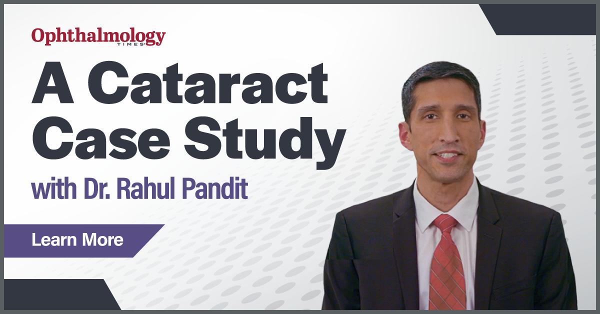 A Cataract Case Study with Dr. Rahul Pandit