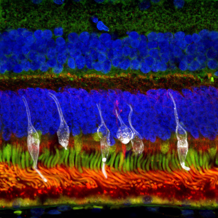Retinal progenitor cells derived from RxCell induced pluripotent stem cells (iPSCs) can mature into retina photoreceptors after transplantation into the preclinical models, enabling restored vision. (Image courtesy of NUS Yong Loo Lin School of Medicine)