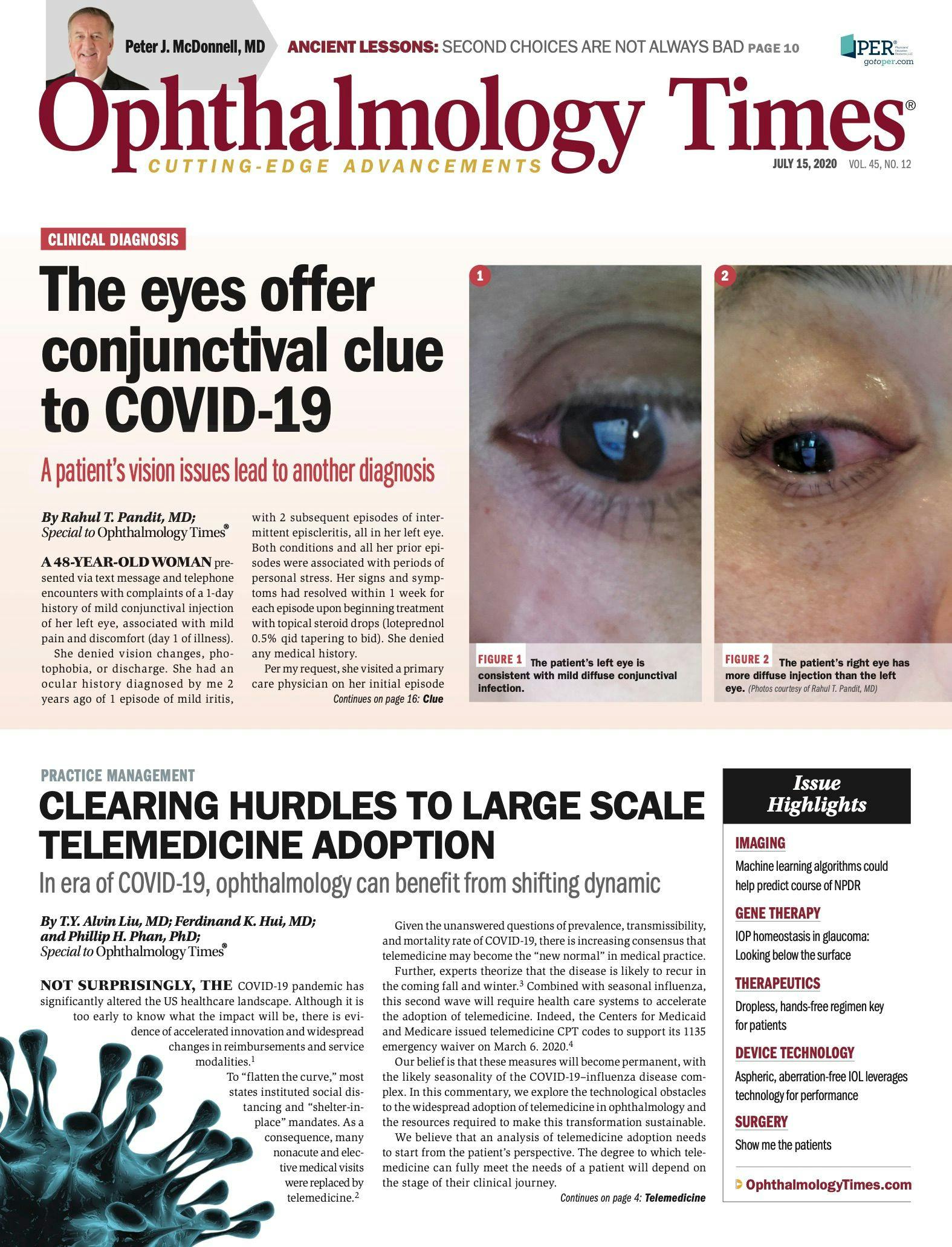 Ophthalmology Times: July 15, 2020