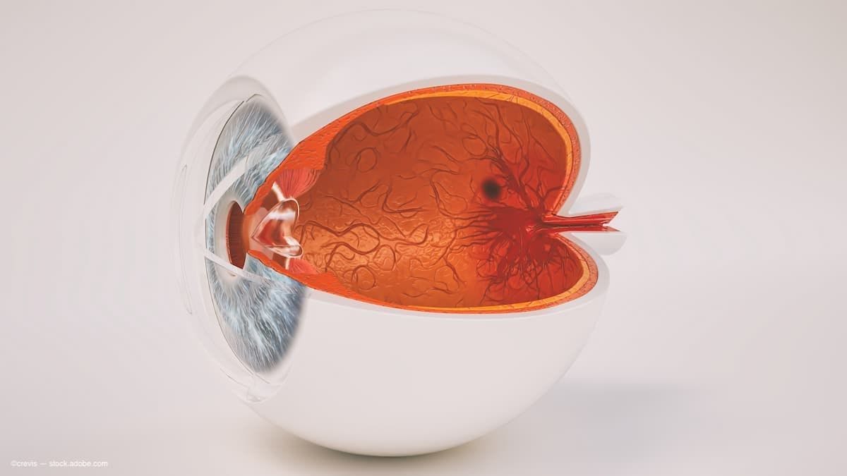 Retinal vascular abnormalities may be surrogate biomarkers of Alzheimer’s Disease before symptom onset