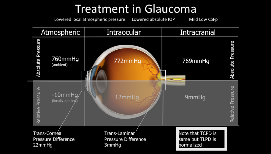 Should we treat CSF pressure in glaucoma?
