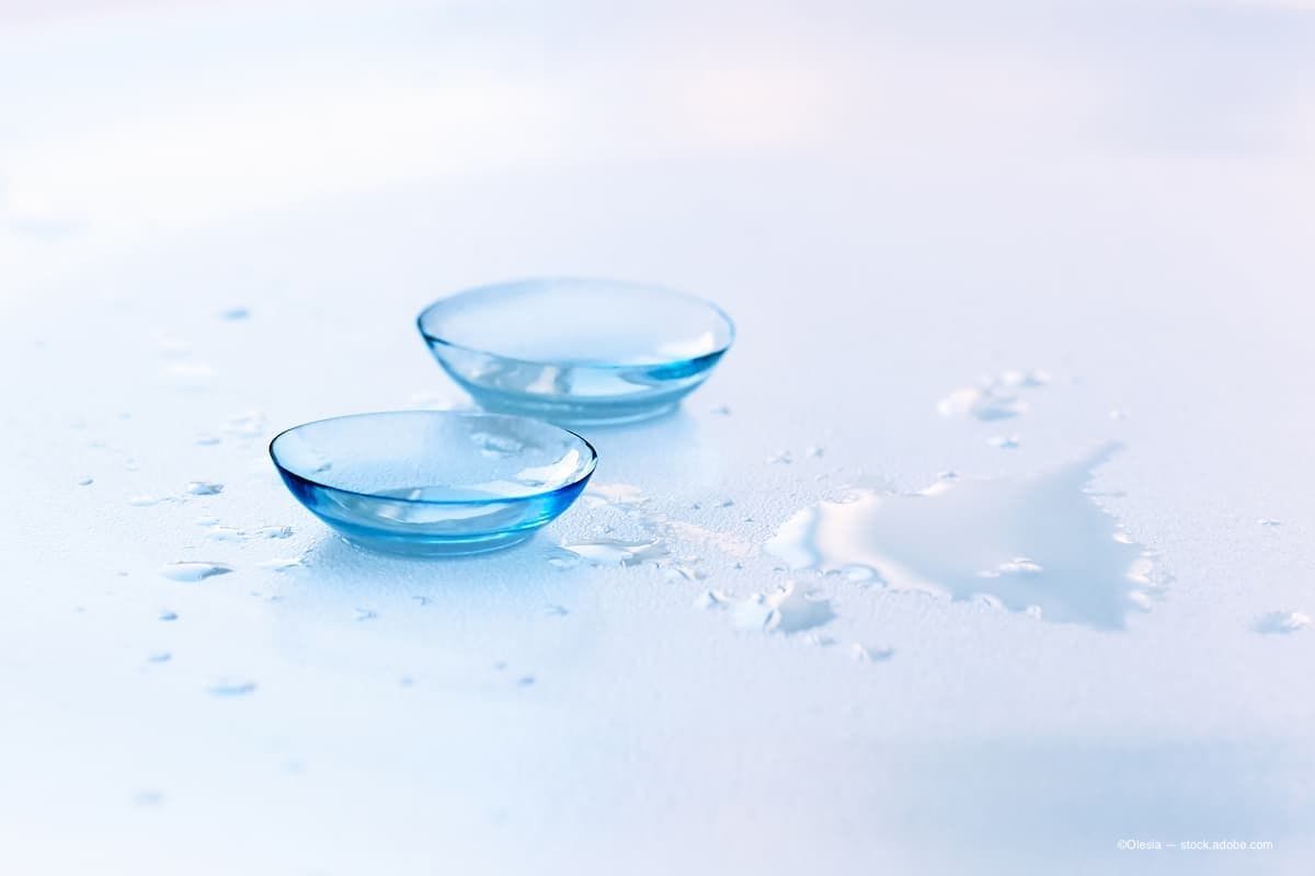 an image of contact lenses sitting in liquid on a table. (Image Credit: AdobeStock/Olesia)
