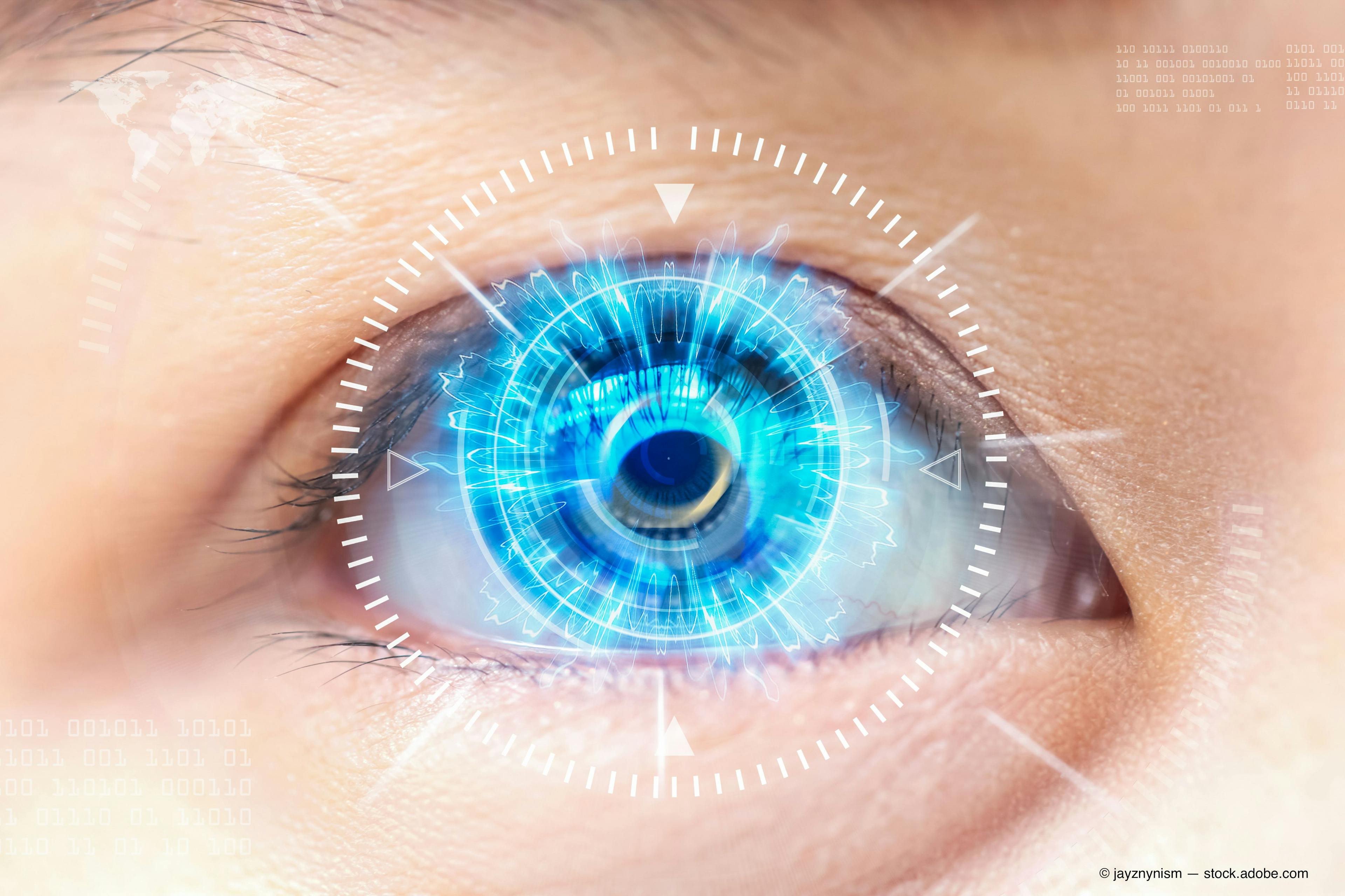 Using technology to manage corneal challenges before cataract surgery