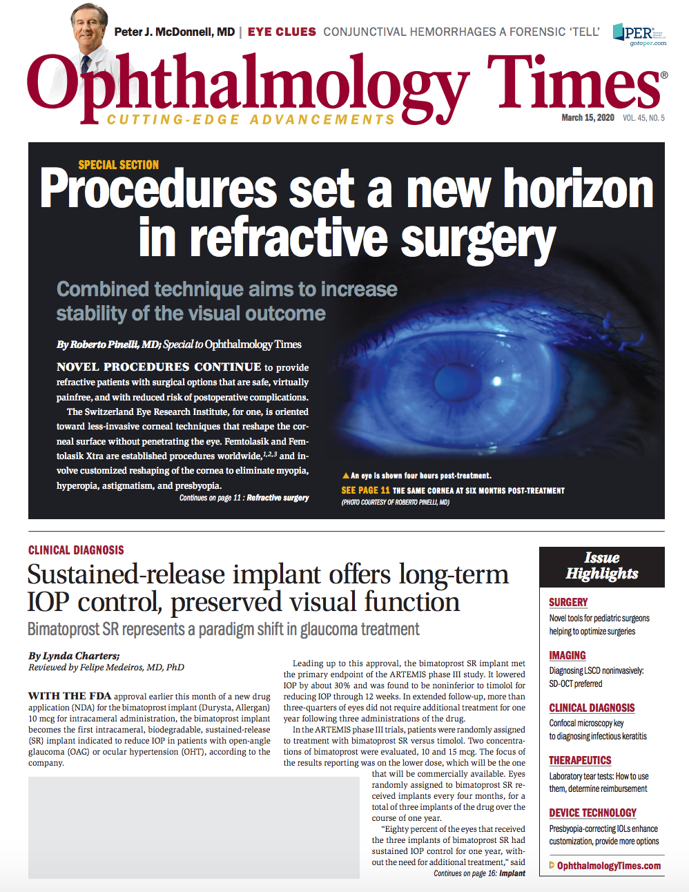 Ophthalmology Times: March 15, 2020