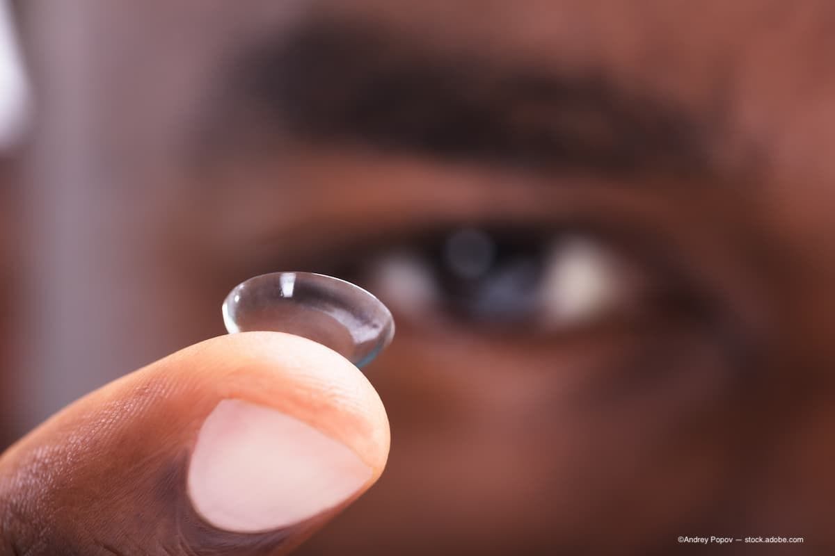 Study: Contact lenses to diagnose glaucoma