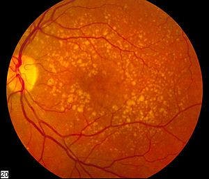 Discovery by USC investigators shows long-term viability of stem cell derived retinal implant