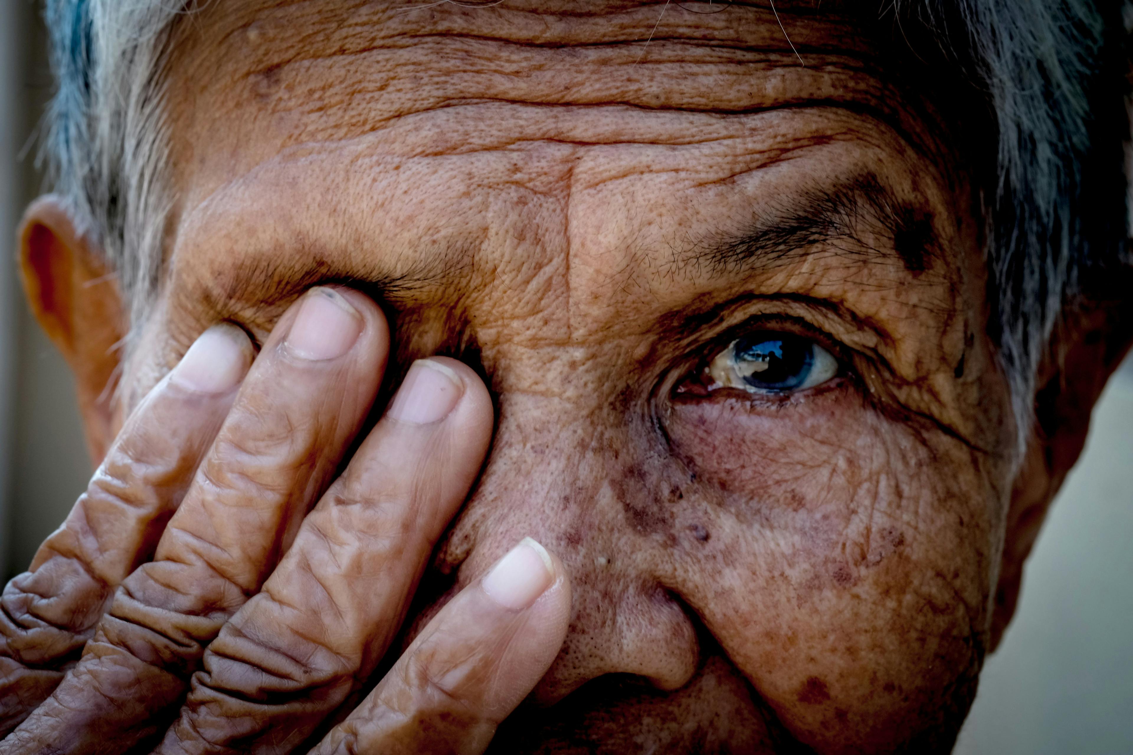 An older person covering one eye with their hand