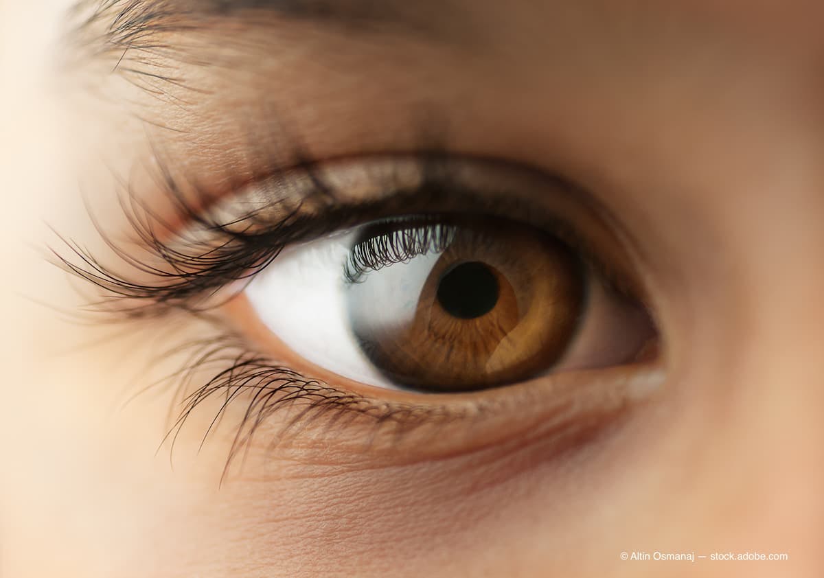 IAPB introduces 'Focus on Child Eye Health'
