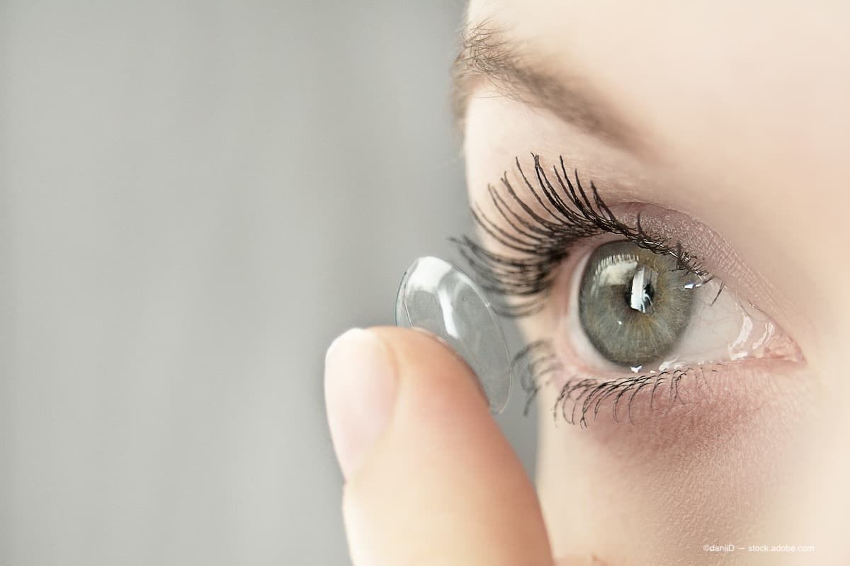 a woman putting a contact lense into her eye. (Image Credit: AdobeStock/daniiD)