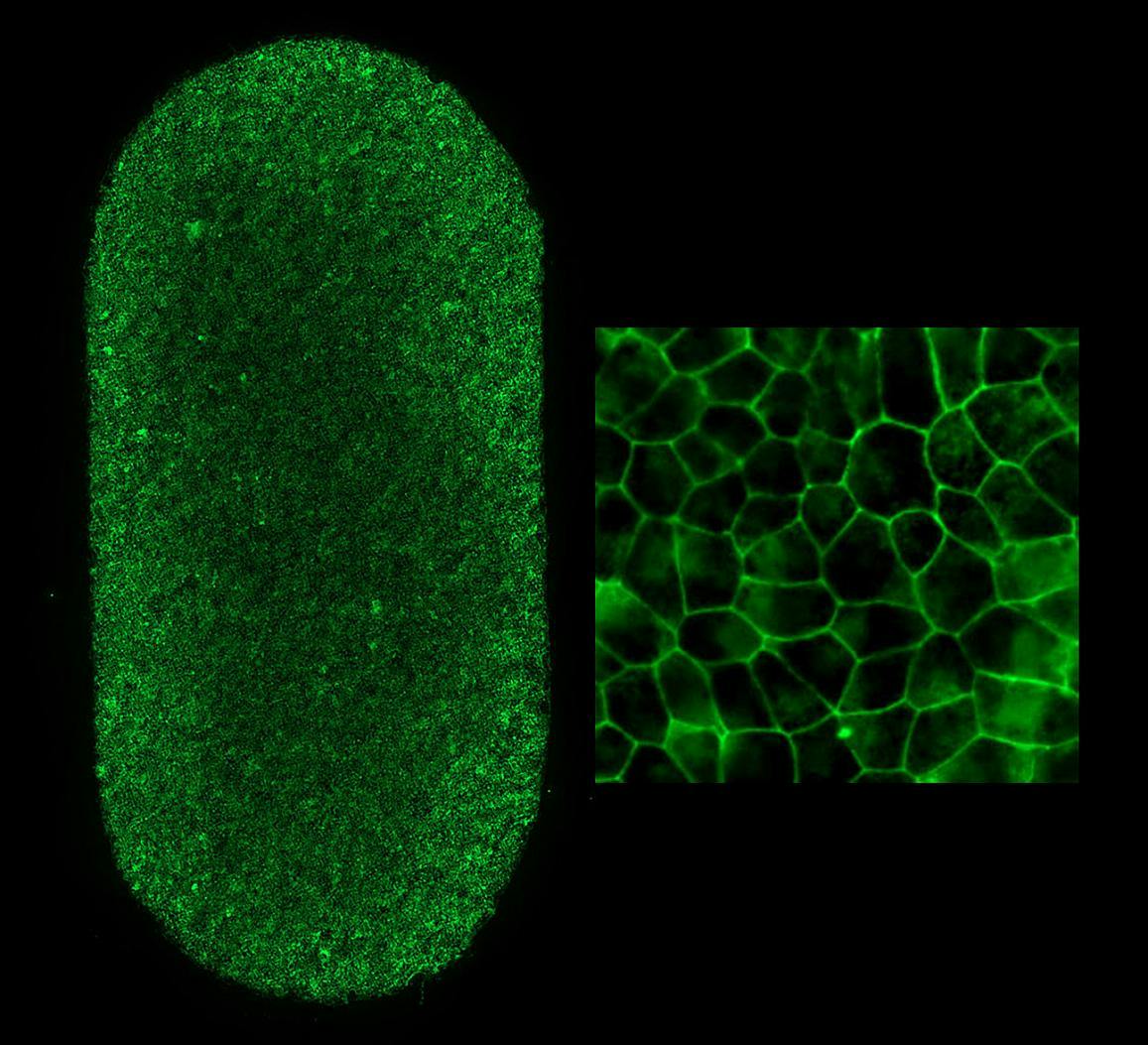 Left shows an image of the full-RPE-patch (2 x 4 mm). Each dot is an RPE cell with the borders stained green. Each patch contains approximately 75,000 RPE cells. Right image shows patch RPE cells at higher magnification. (Image courtesy of Kapil Bharti, P.D, NEI)