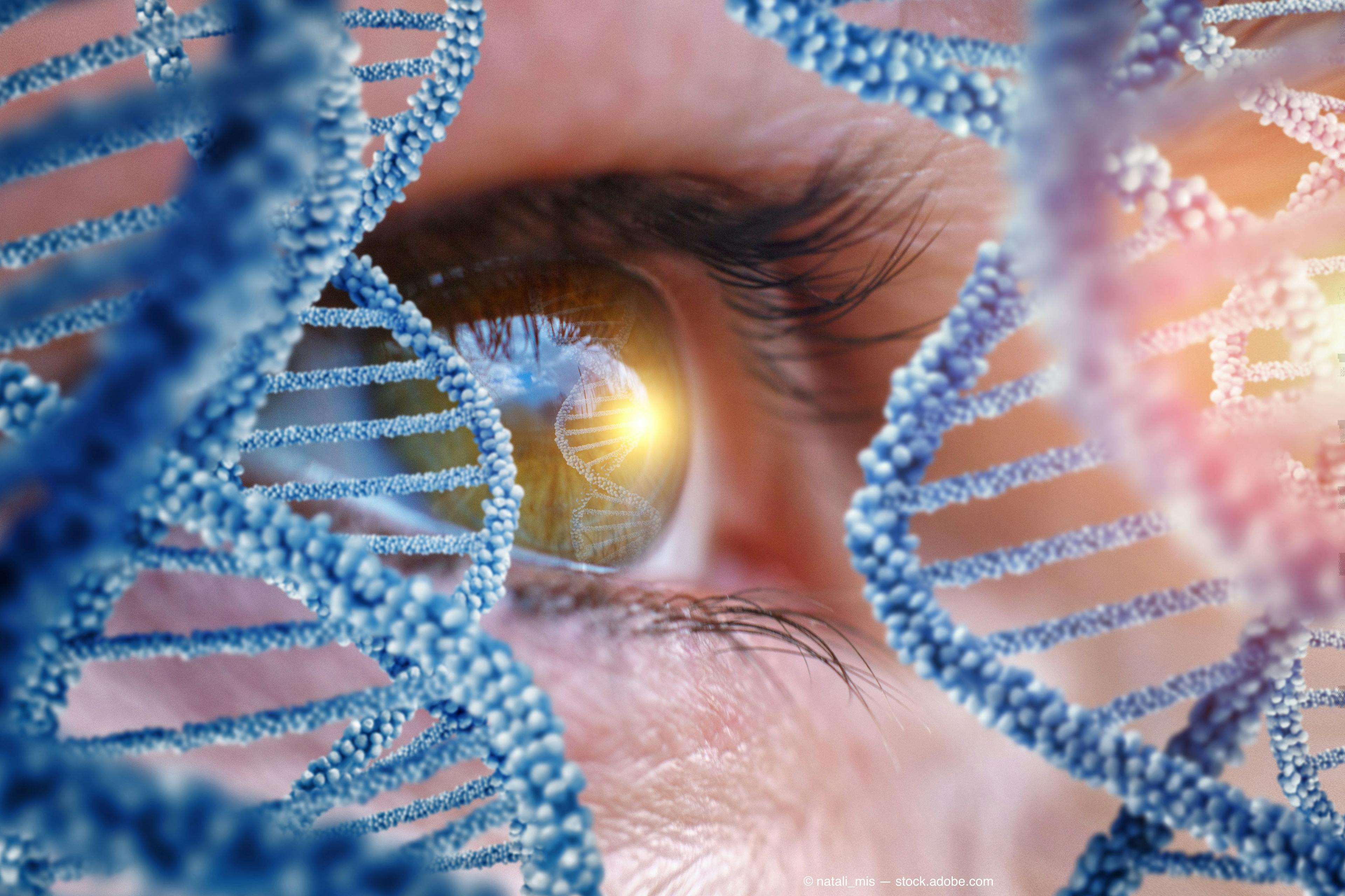 Genetic investigations have garnered a wealth of information about glaucoma, the third most inherited human disease, which has pinpointed specific genes involved in early-onset familial disease with autosomal dominant or recessive inheritance as well as genetic risk factors for common glaucoma types with complex inheritance patterns.