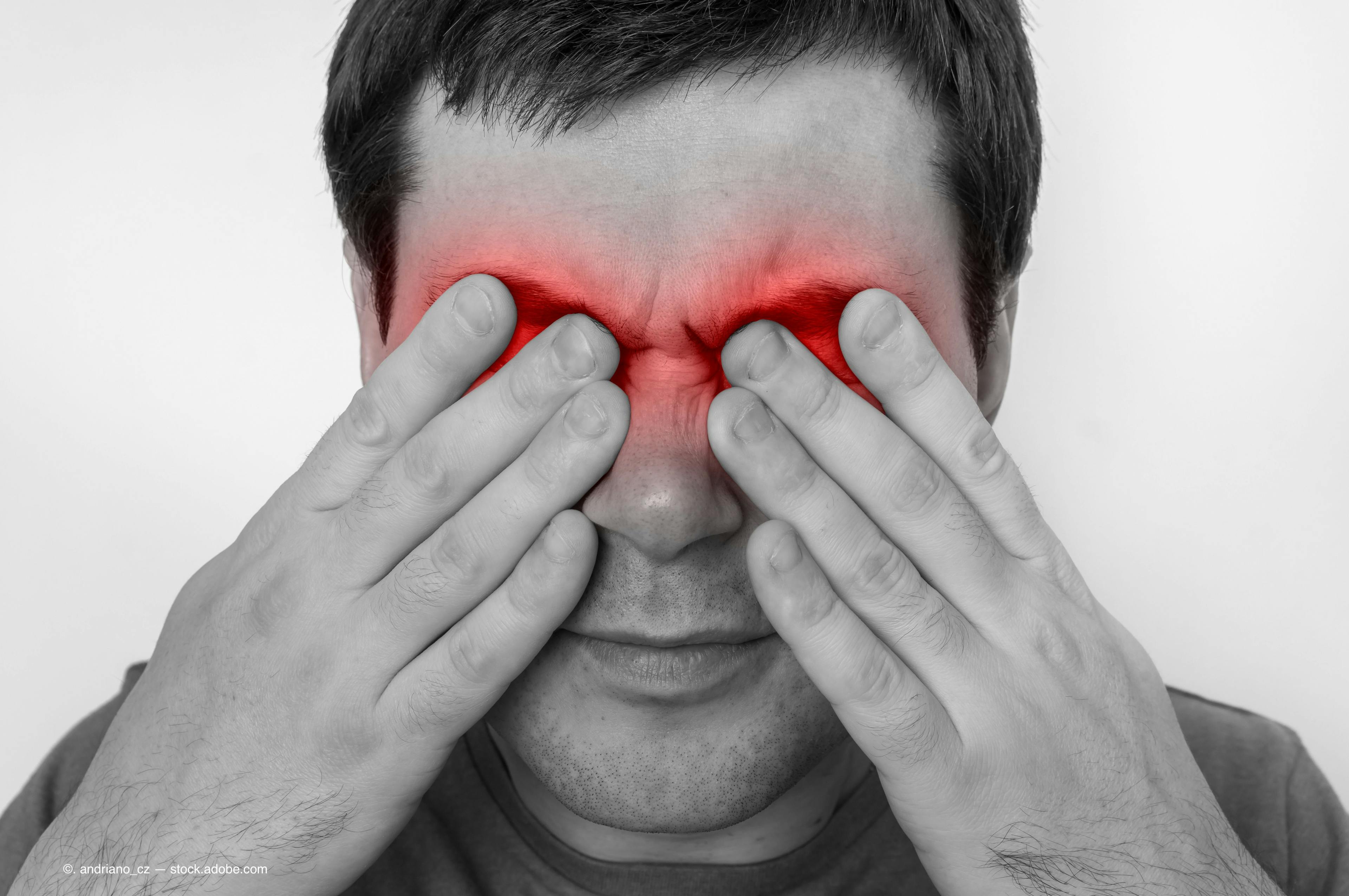 Study: Sore eyes a common symptom in COVID-19 patients