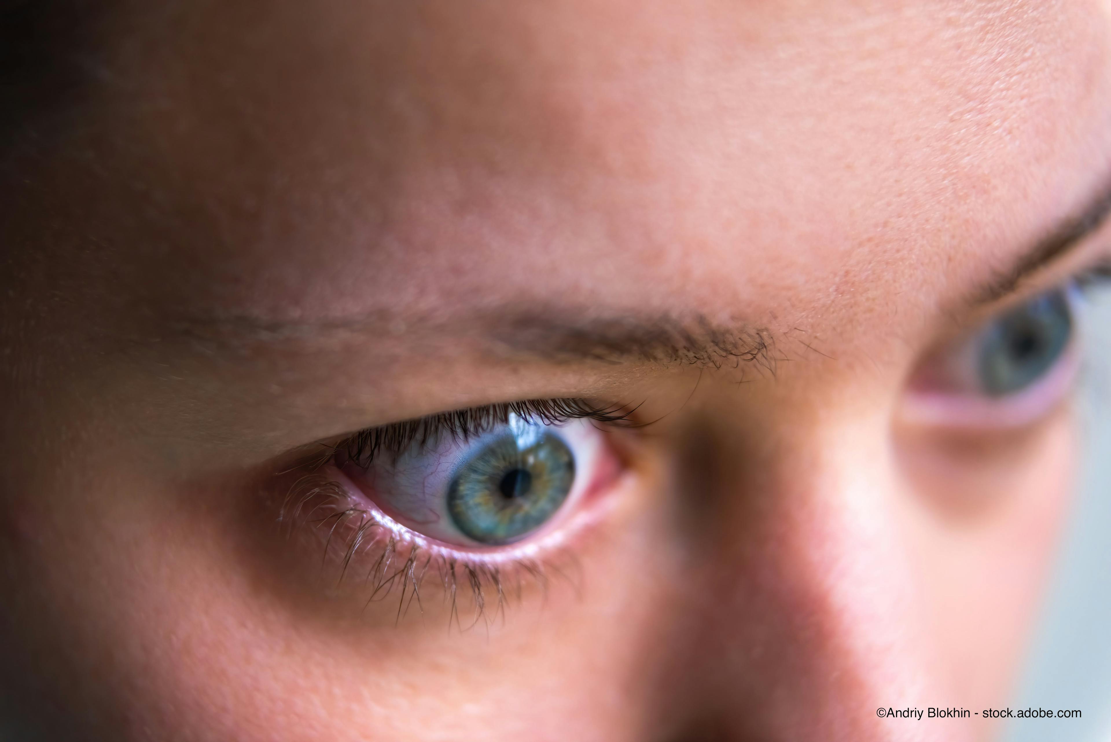 Focusing on thyroid eye disease (TED): Rare but devastating