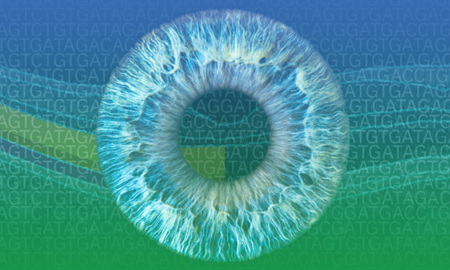 Large-scale study enables new insights into rare eye disorders 