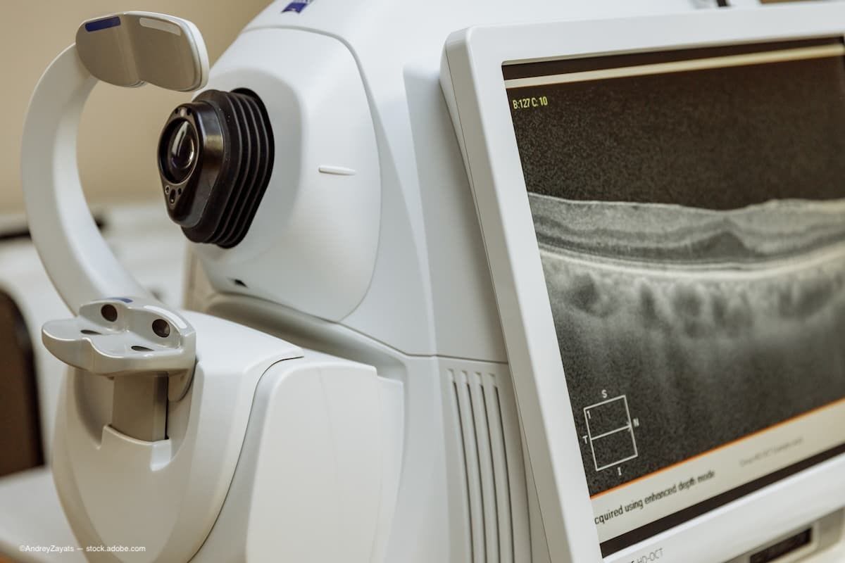 OCT proves valuable for detecting macular pathologies in patients with scleritis