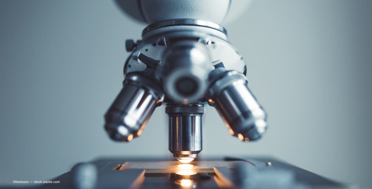a close image of a microscope looking at a slide with dna on it. (Image Credit: AdobeStock/kkolosov)