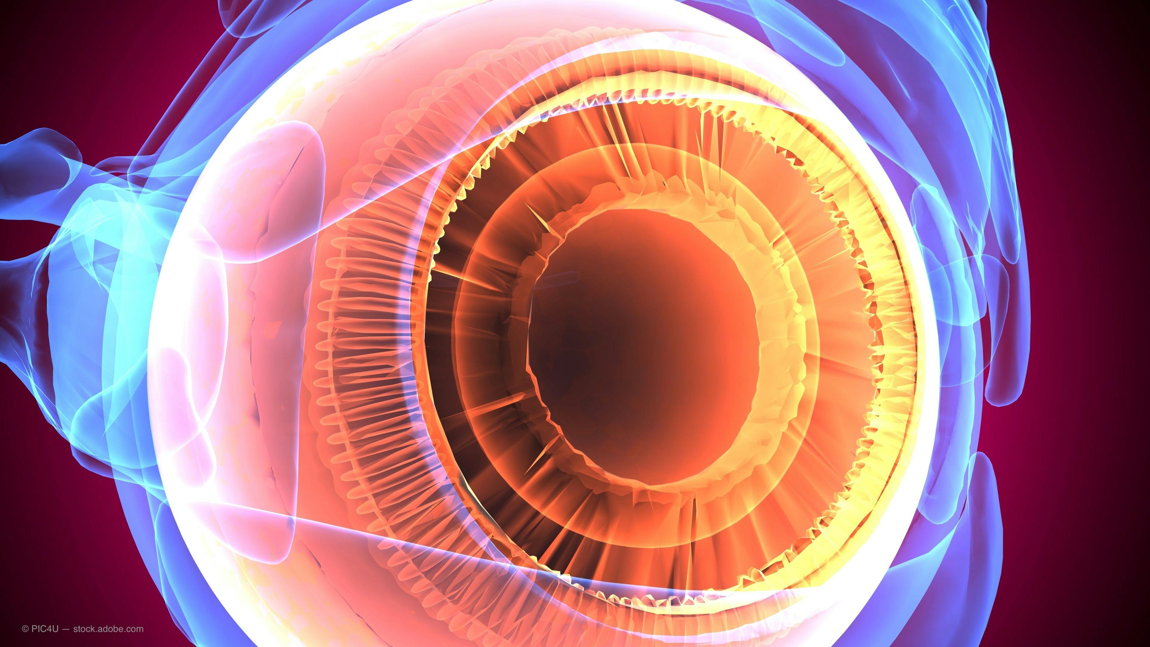 Patient glaucoma management focuses on pivotal studies