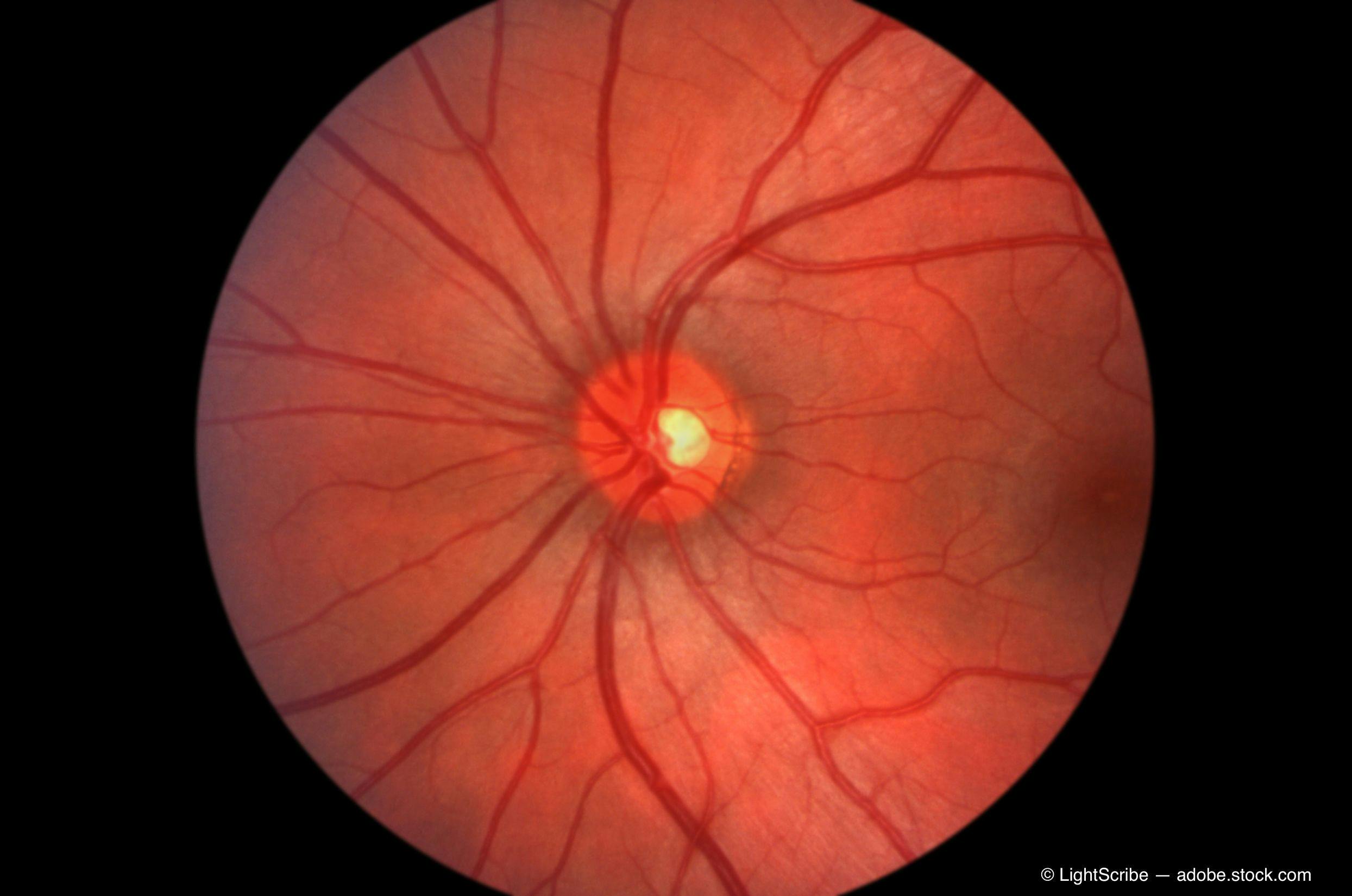 Retina - optic nerve