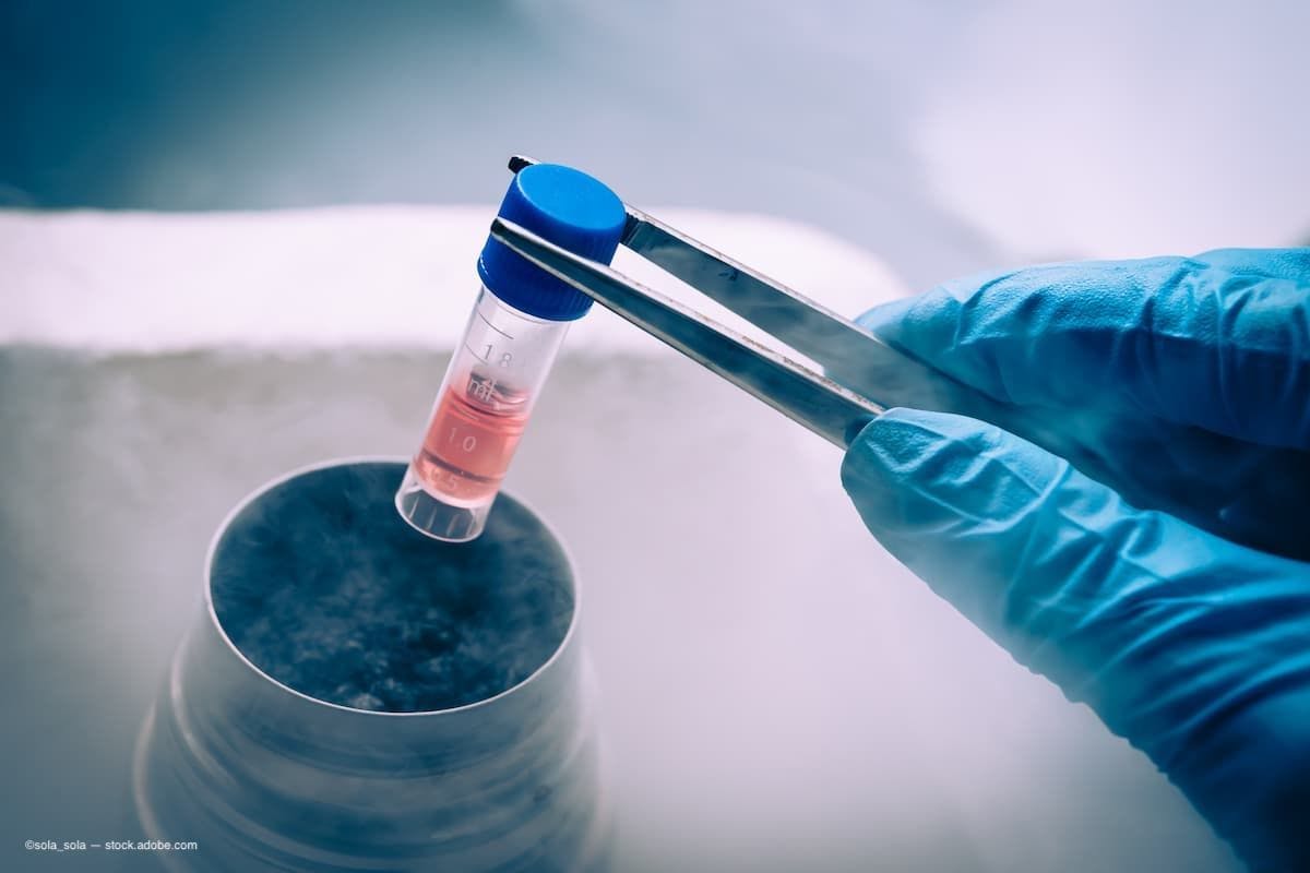 A bial of cells being put into liquid nitrogen. (Image Credit: AdobeStock/sola_sola)