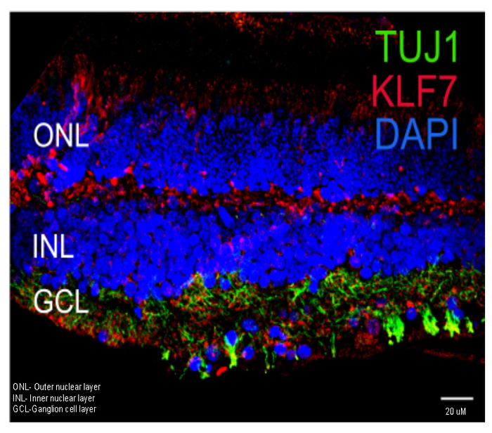 KLF7(red),which could accelerate retinal ganglion cell (RGC) generation, is generally expressed in the RGC layer marked by TUJ1+ neurons (green) of retina. Lab grown RGCs could replace damaged RGCs as a potential therapy for eye disorders. (Image courtesy of Pradeep Gautam, Institute of Molecular and Cell Biology (IMCB), A*STAR)