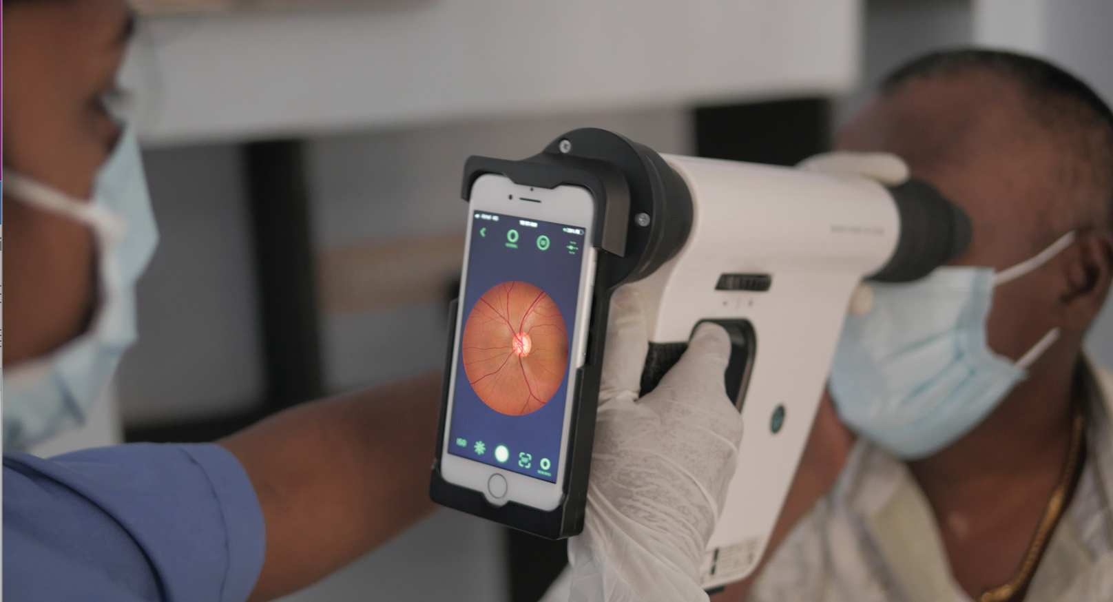 ICYMI: Smartphone-based fundus camera provides option for glaucoma screening
