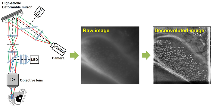 Image acquisition and image processing using the mouse conjunctiva as an example. (Image courtesy of POSTECH)