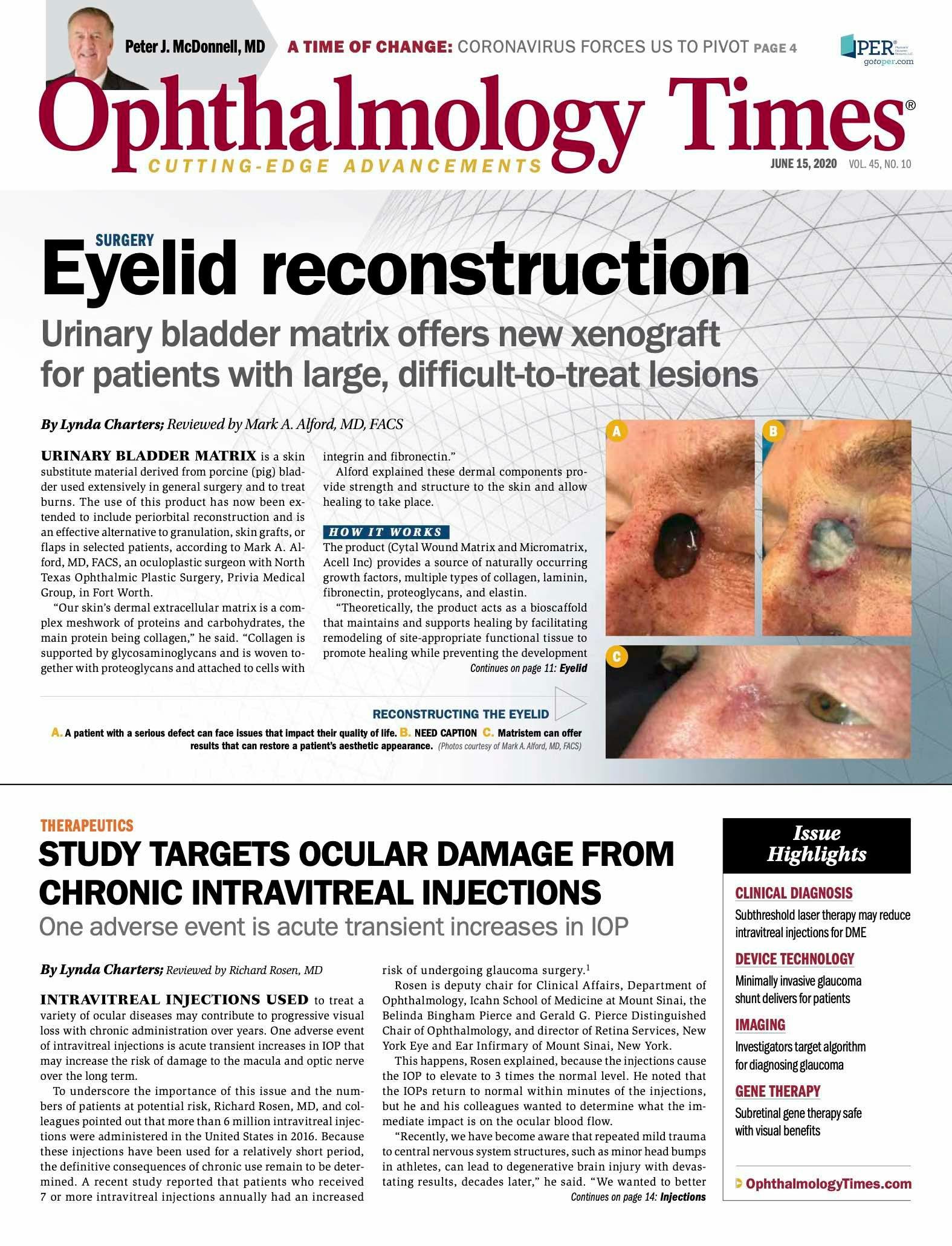 Ophthalmology Times: June 15, 2020
