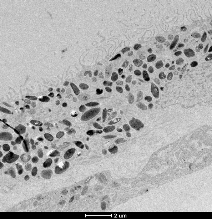 Black and white electron microscopy imaging of retinal pigment epithelium cells. (Image courtesy of Grace Lidgerwood, MD)