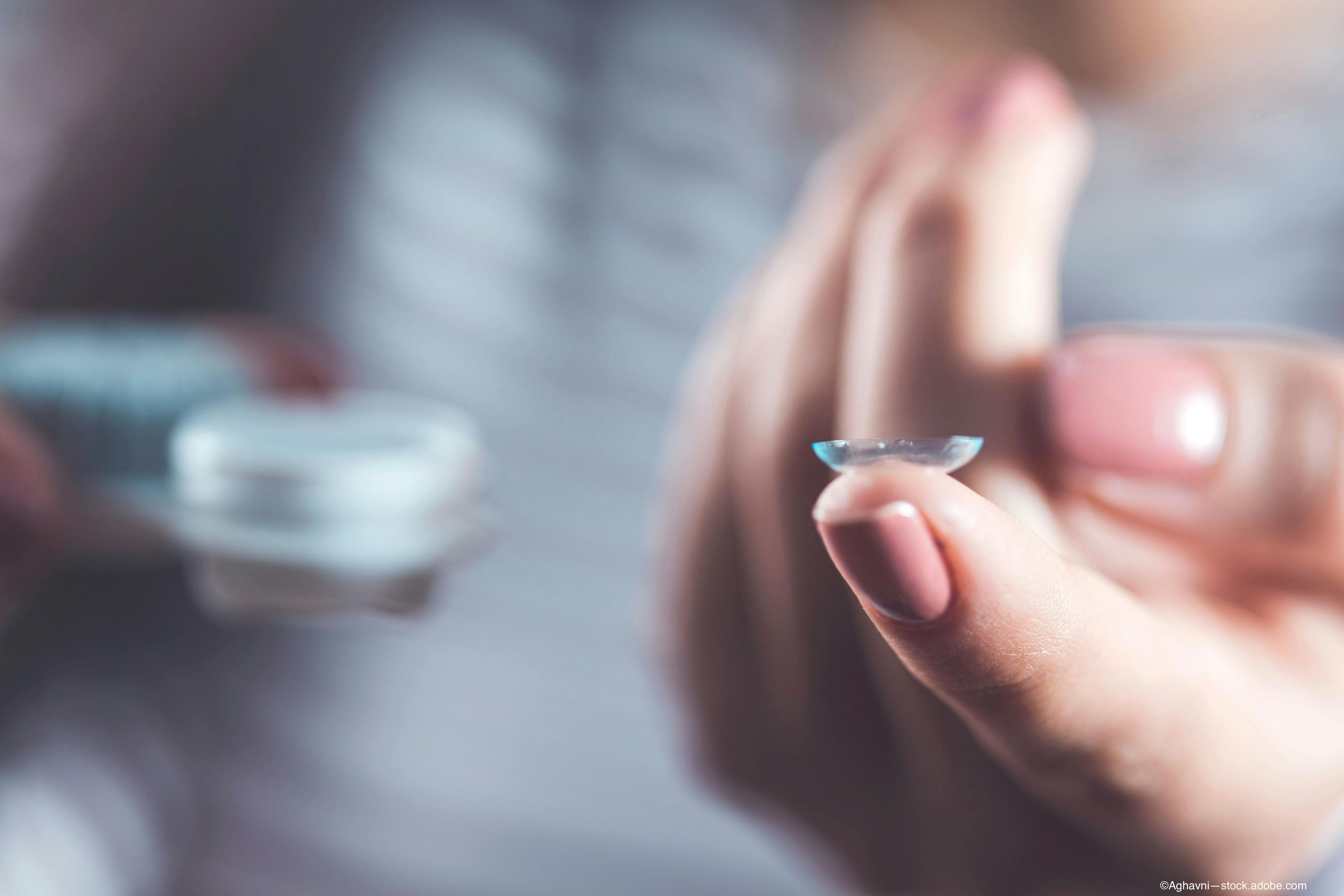 drug-eluting contact lens on finger following positive results of phase 2b trial for open angle glaucoma - Image credit: Adobe Stock /Aghavni